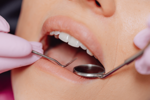 cuidados-implantes-dentales