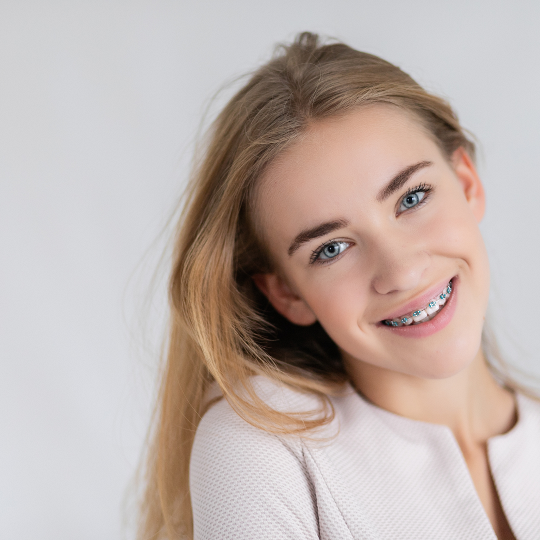 Diferencia entre brackets metálicos y estéticos ⋆ Clínica Dental CEMEQ