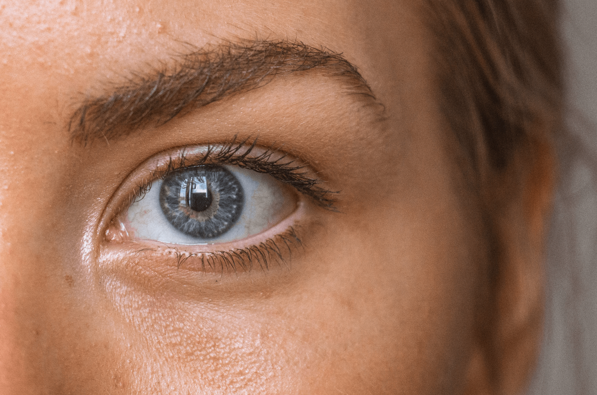 Blefaroplastia u operación párpados caídos